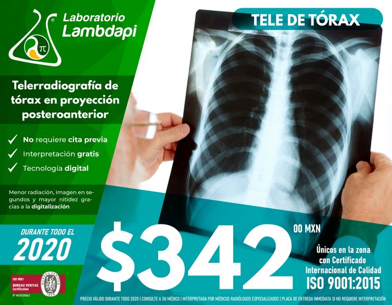 Prueba De Embarazo Laboratorio Azteca Order Cheapest Save Jlcatj Gob Mx